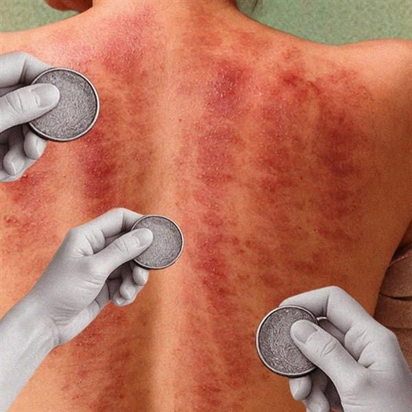 Cao Gio, the ancient Vietnamese wellness hack for curing colds