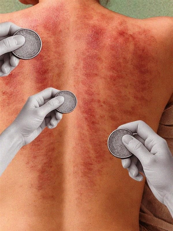 Cao Gio, the ancient Vietnamese wellness hack for curing colds