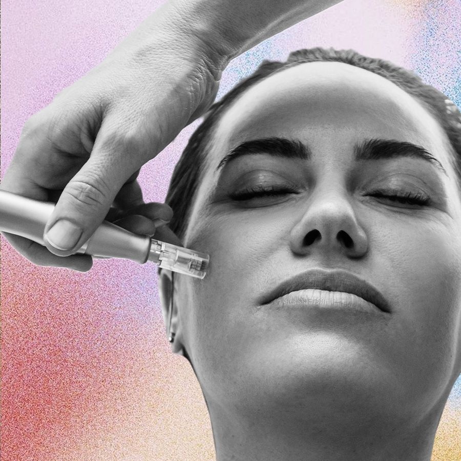 An image of a woman getting microneedling with a dermapen. A beauty writer from The Nod tries out Morphiya—a new exosome facial treatment
