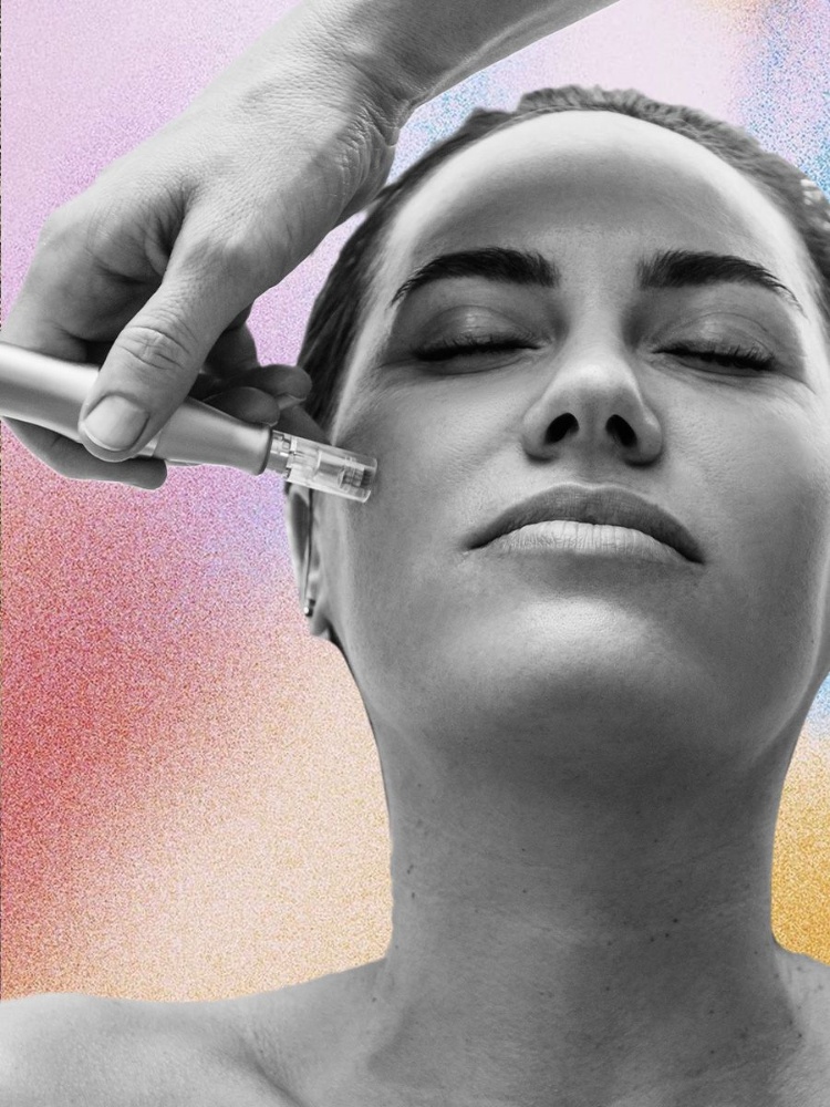 An image of a woman getting microneedling with a dermapen. A beauty writer from The Nod tries out Morphiya—a new exosome facial treatment